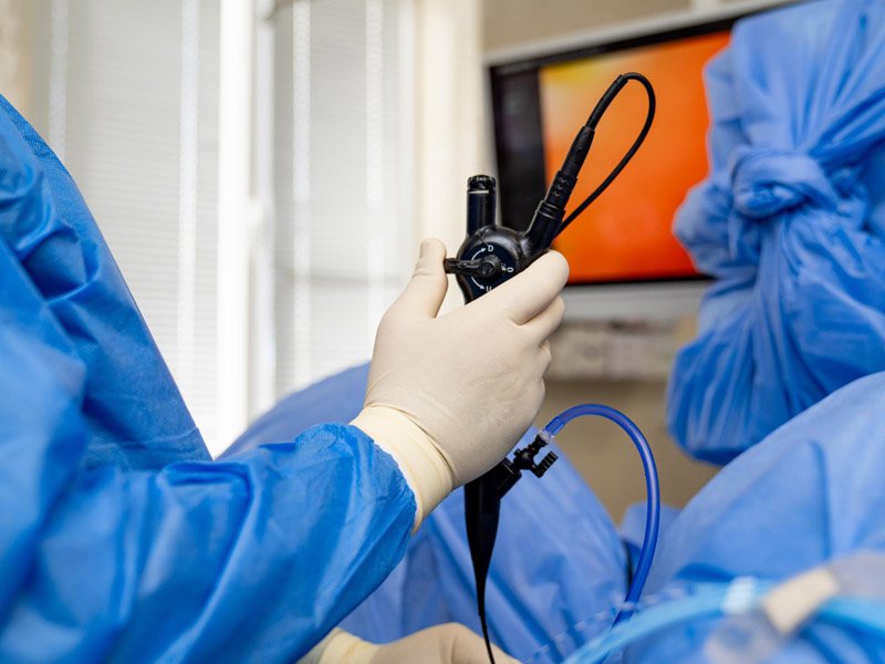 Colonoscopia / Endoscopia em São Bernardo