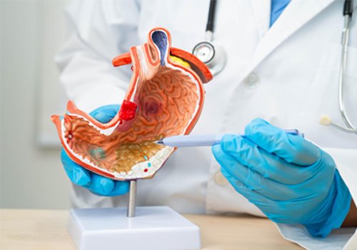 Endoscopia digestiva alta