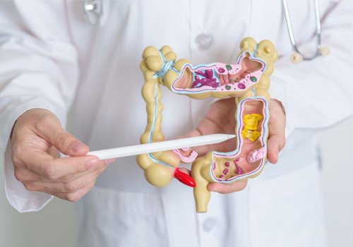 Retossigmoidoscopia flexível